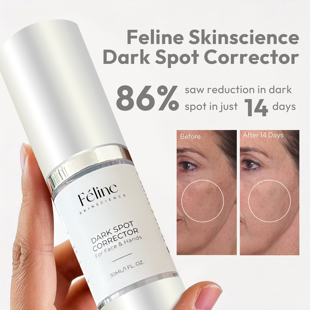 Dark Spot Corrector | 1+1 FREE